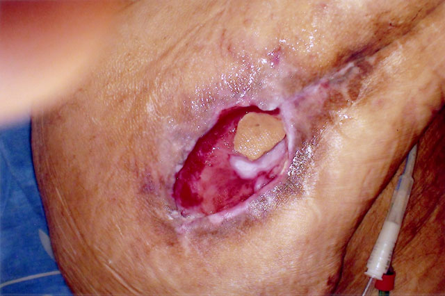 ψευδομοναδα