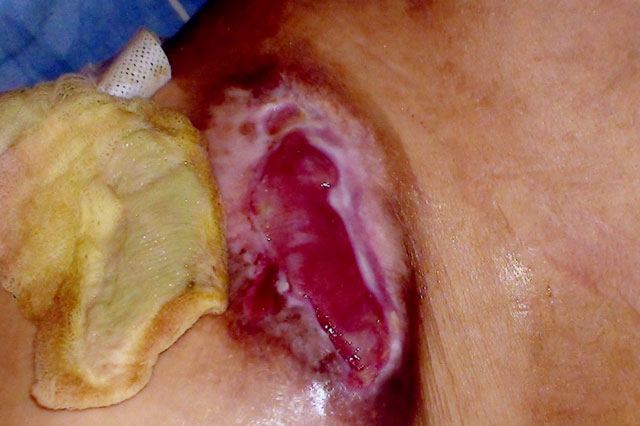 ψευδομοναδα