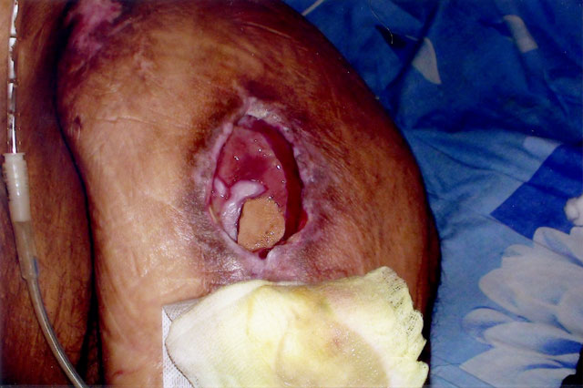 ψευδομοναδα