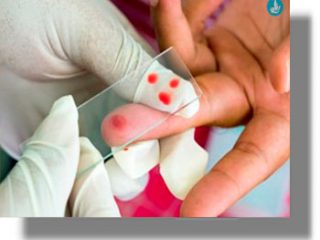 Ο «εφιάλτης» της ελονοσίας ξύπνησε στο νησί της Κω