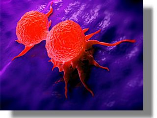 H λίστα του ΤΡΟΜΟΥ: Τα 116 πράγματα που προκαλούν καρκίνο, σύμφωνα με τον Παγκόσμιο Οργανισμό Υγείας