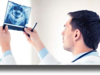 Καρκίνος στόματος: Ανησυχία για τα πολλά κρούσματα νεαρής ηλικίας