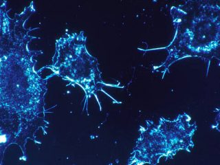 Ολοκληρωμένη θεραπεία για τον καρκίνο μέσα στο 2020 «υπόσχονται» επιστήμονες