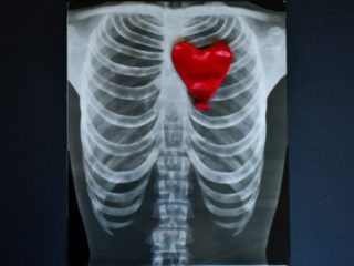 Σαφώς λιγότερα καρδιακά επεισόδια όσοι παίρνουν αρκετή από αυτήν τη βιταμίνη: Σε ποιες τροφές υπάρχει